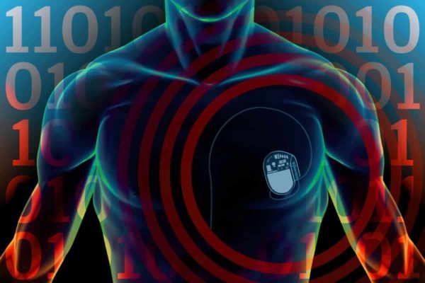 Is It Possible to Hack Medical Devices like Pacemaker and Insulin Pumps